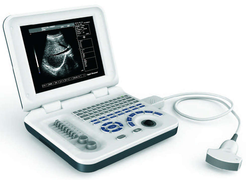 S30 Full Digital Ultrasound Diagnostic System