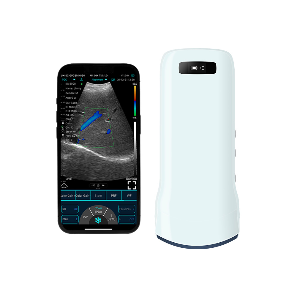 192E Wireless Convex Color Doppler probe