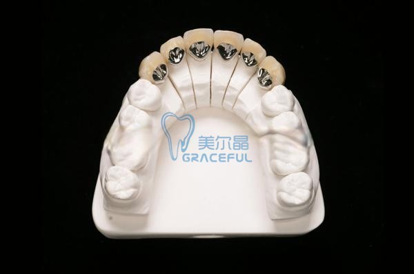 普通烤瓷