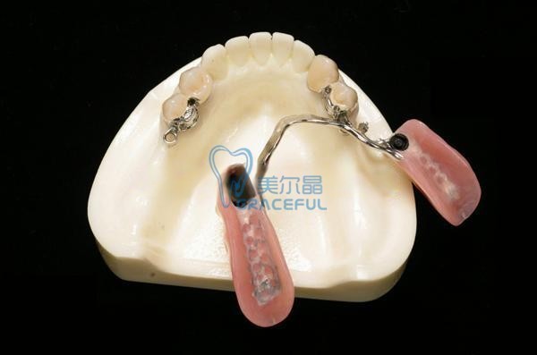 精密附件