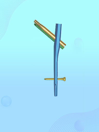 Spine Internal Fixation