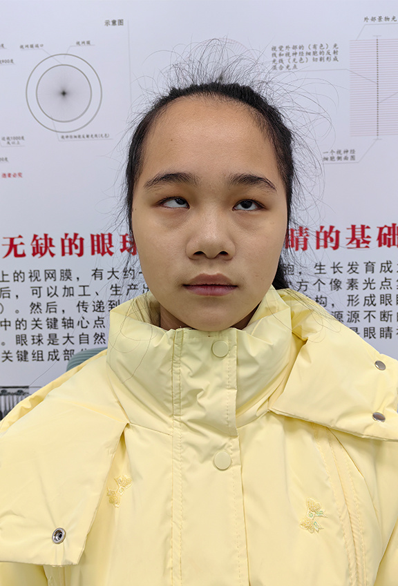 治療前