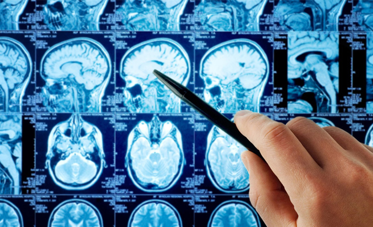 Oncology Clinical Trials Oncology Clinical Trials
