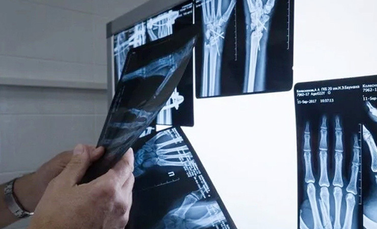 Musculoskeletal Clinical Trials Musculoskeletal Clinical Trials