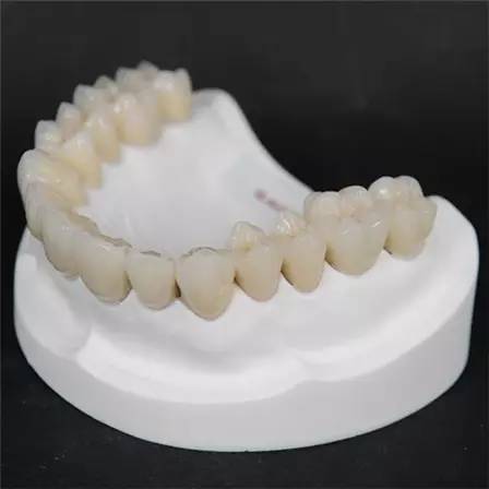 3D打印純鈦烤瓷牙