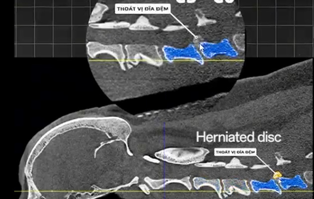 Case of Intervertebral Disc Herniation in a Vietnamese French Bulldog