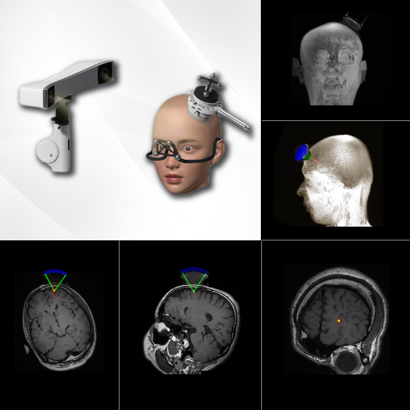 3D 高精度光学导航系统