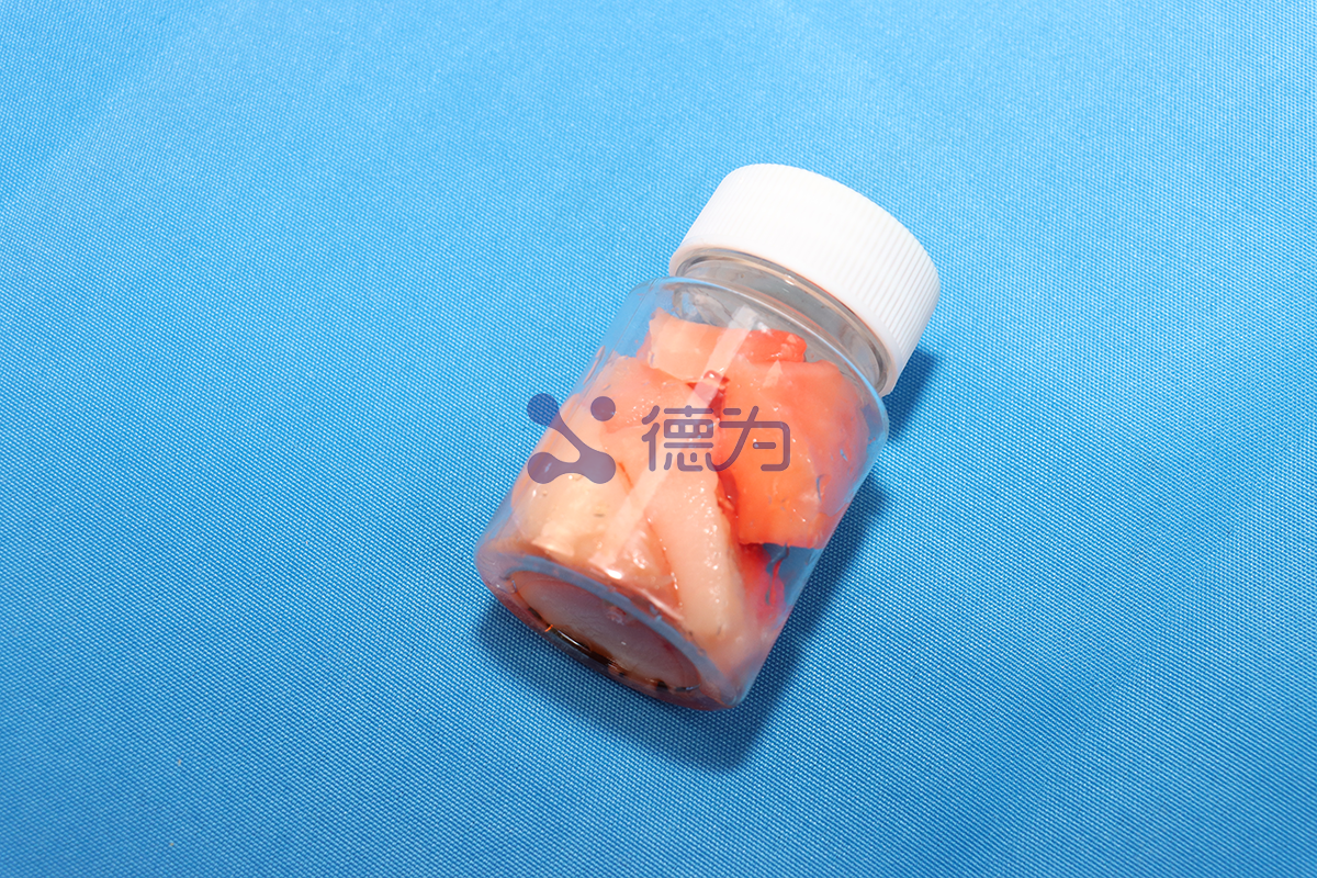 德为医疗血栓仿体：破解医疗器械公司取栓研发测试难题