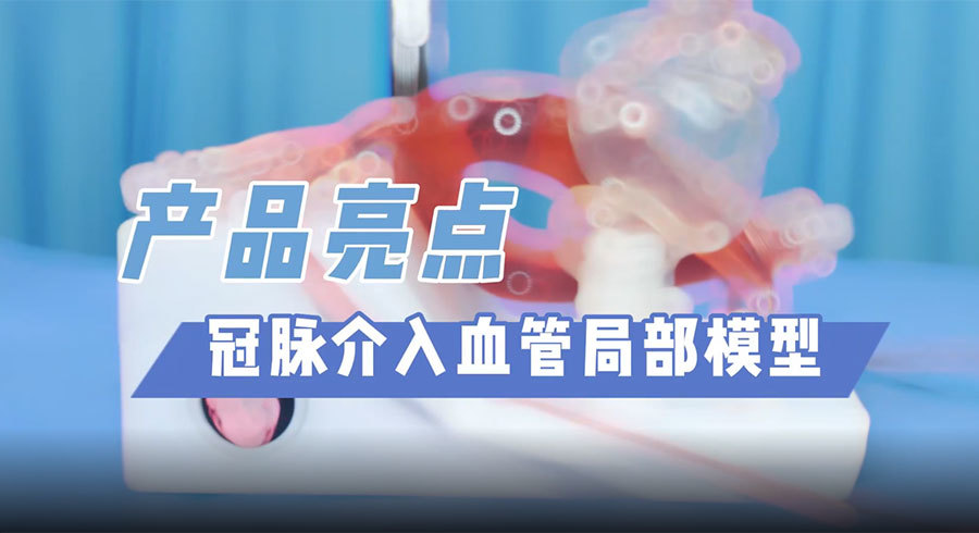 冠脉介入血管局部模型