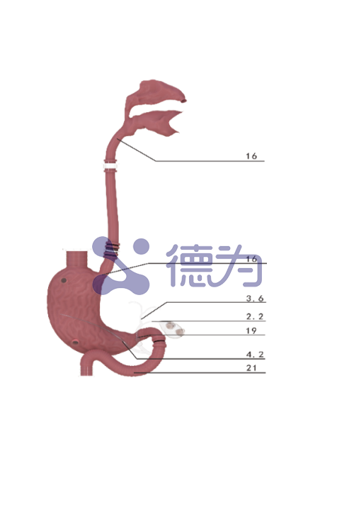 ERCP模型 ERCP模型