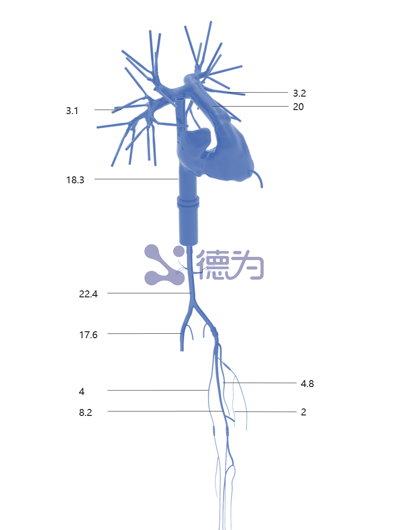 肺动脉模型 单侧款 肺动脉模型 单侧款