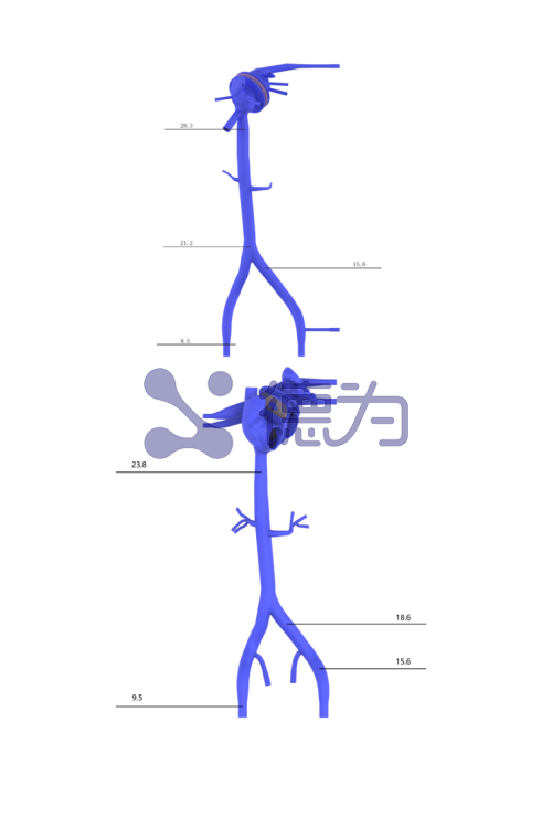 房间隔穿刺模型 房间隔穿刺模型