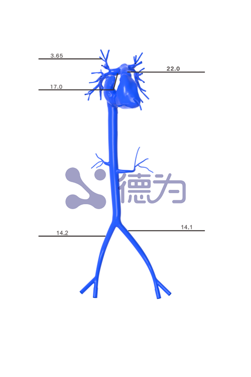 肺动脉模型 肺动脉模型
