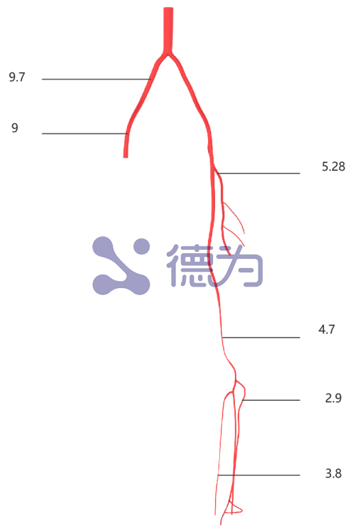 下肢动脉模型 下肢动脉模型