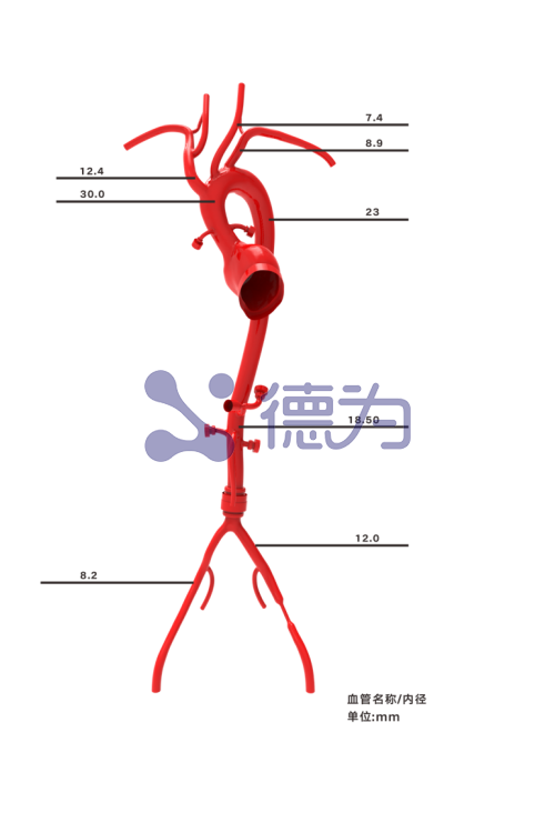 主动脉弓模型 主动脉弓模型