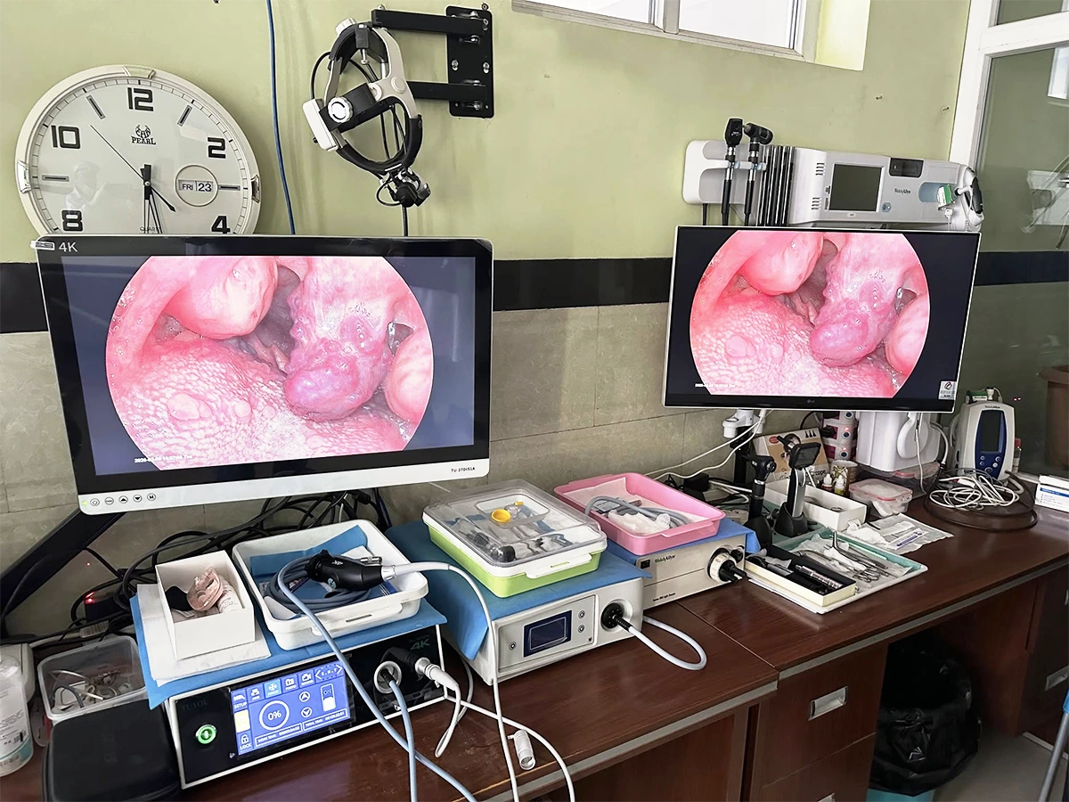 ENT Endoscopy