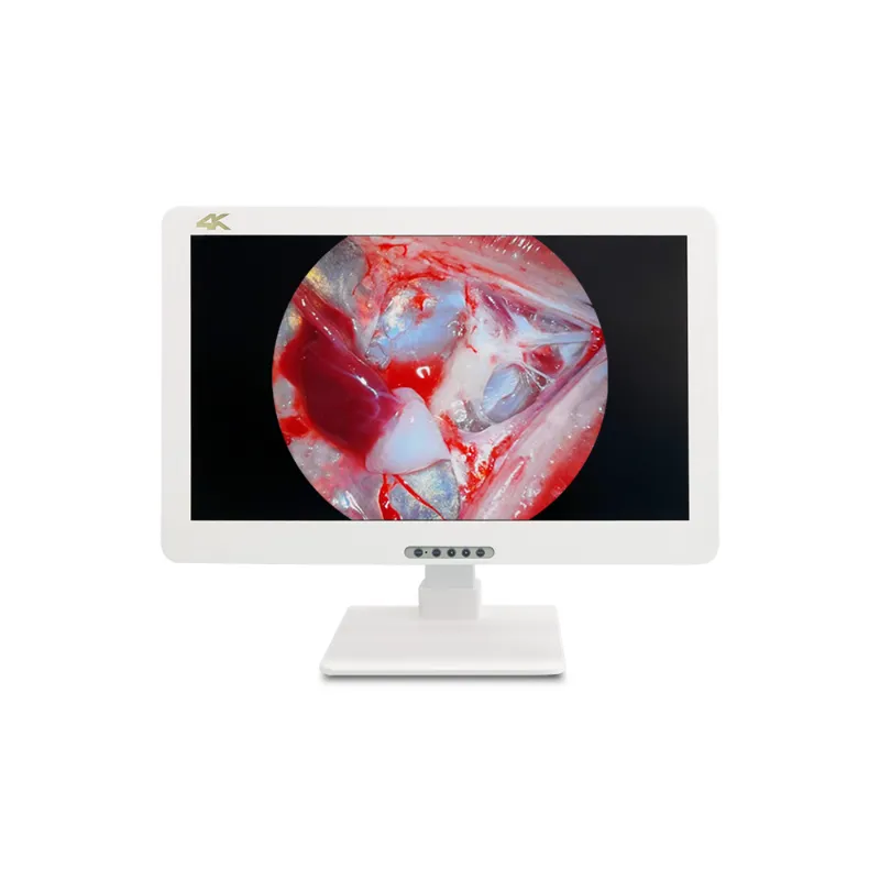 Medical TrolleyMedical-Grade Display Monitors
