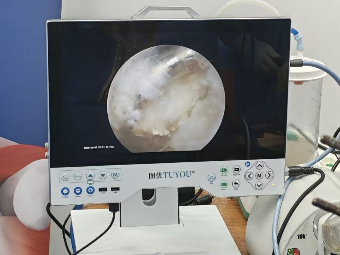 Arthroscopy