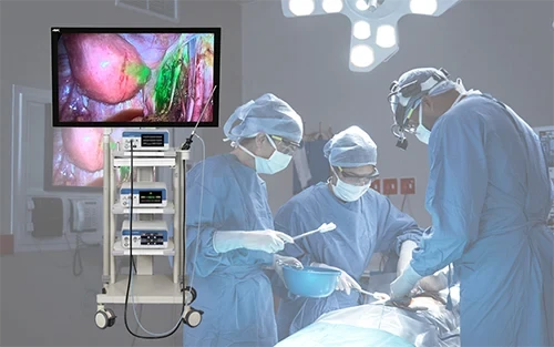 Revolutionizing Surgery: The Power of 4K Fluorescence Endoscopy for Enhanced Precision and Safety