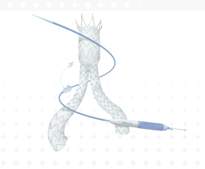 Abdominal aortic stent delivery system