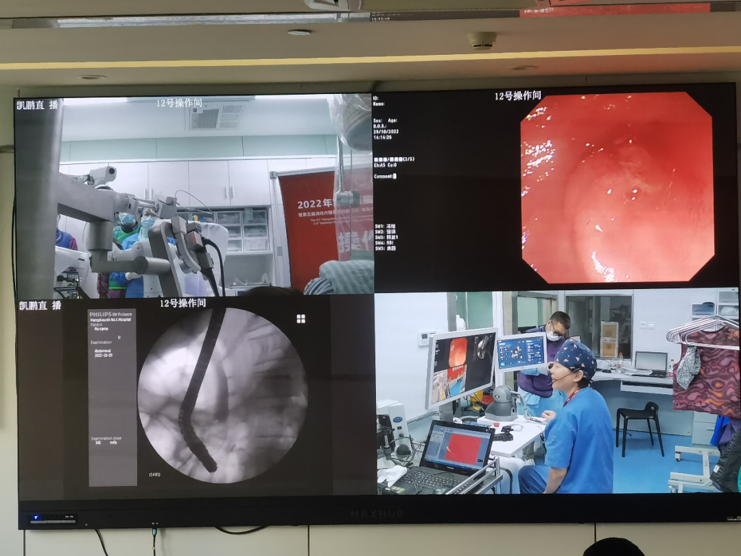 Shanghai Operation Robot  announced the first Robot-assisted human clinical trial of biliary stent placement surgery